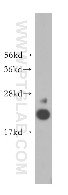 Western Blot (WB) analysis of human testis tissue using ADI1 Polyclonal antibody (15133-1-AP)