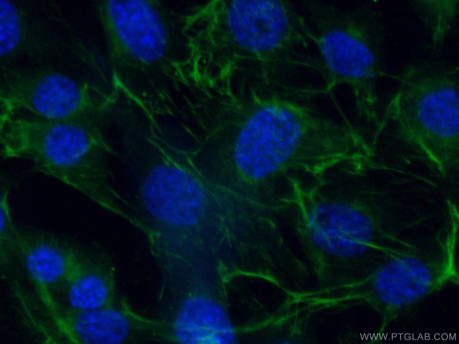 Immunofluorescence (IF) / fluorescent staining of NIH/3T3 cells using Adiponectin Polyclonal antibody (21613-1-AP)