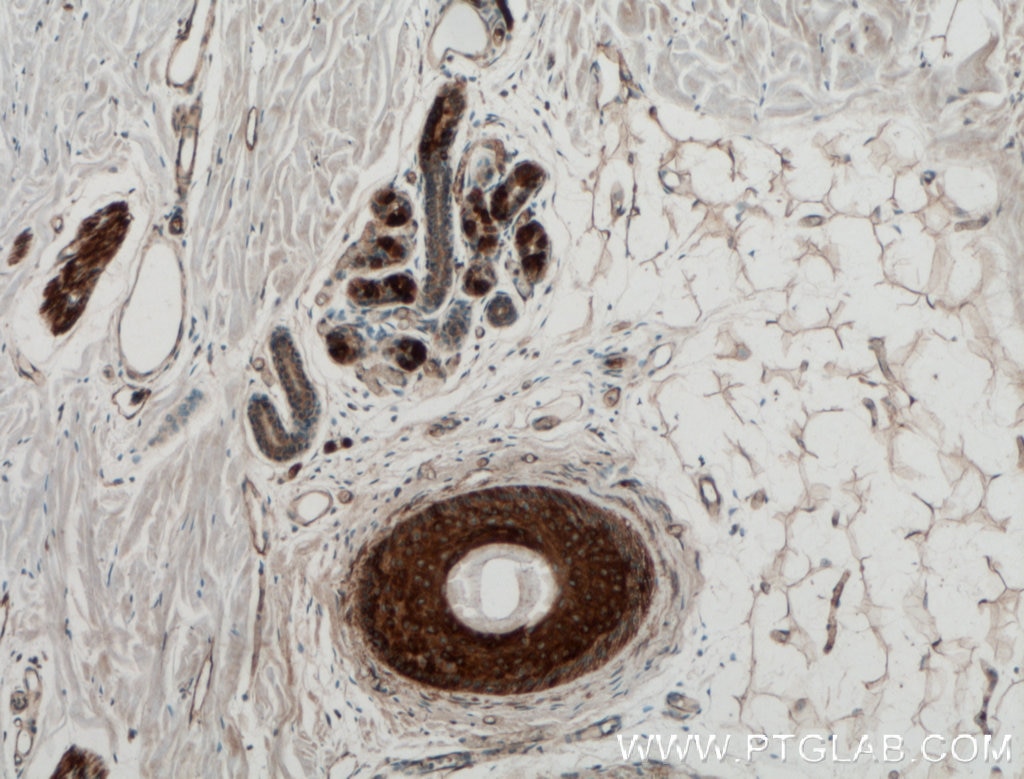 IHC staining of human skin using 21613-1-AP