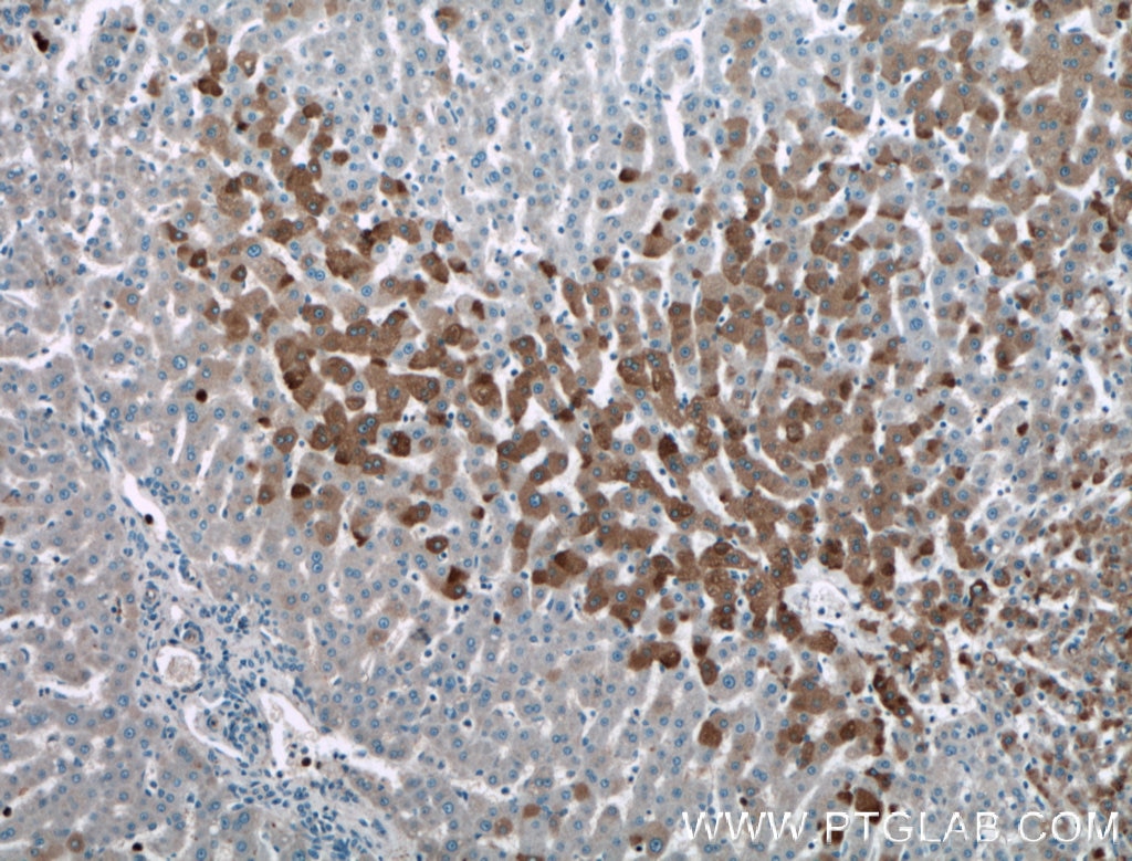 IHC staining of human liver using 21613-1-AP