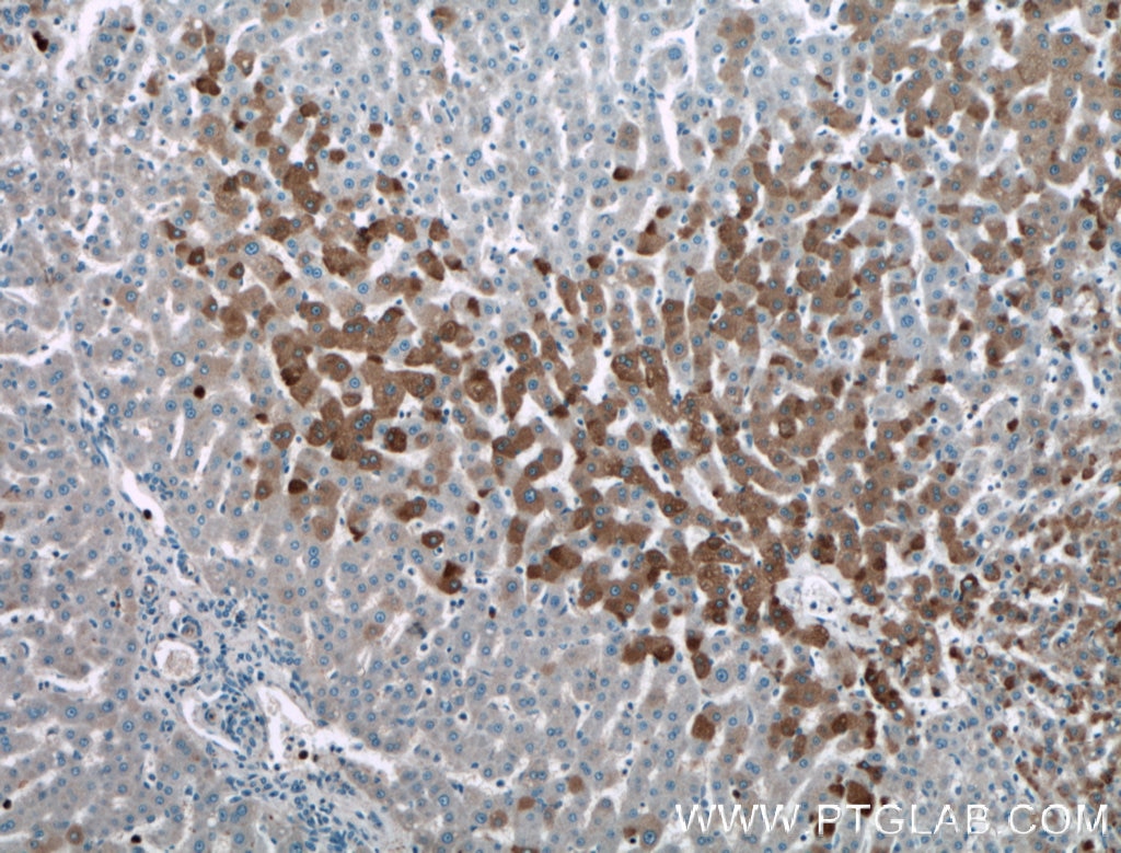 Immunohistochemistry (IHC) staining of human liver tissue using Adiponectin Polyclonal antibody (21613-1-AP)