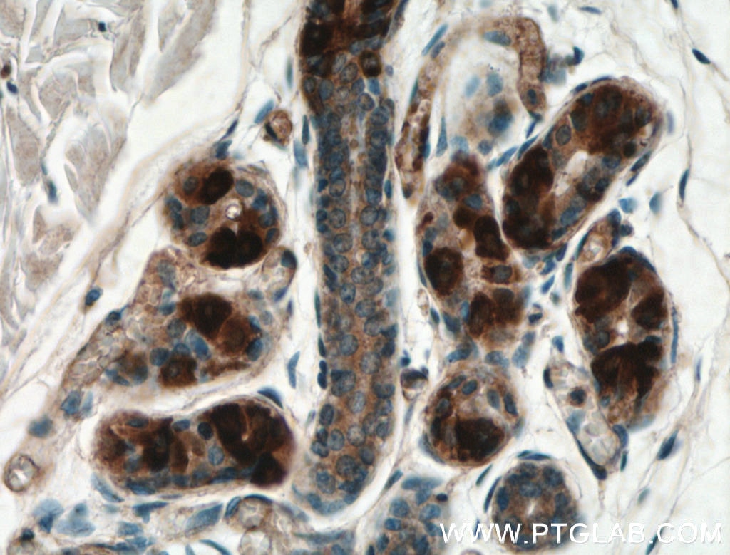 IHC staining of human skin using 21613-1-AP