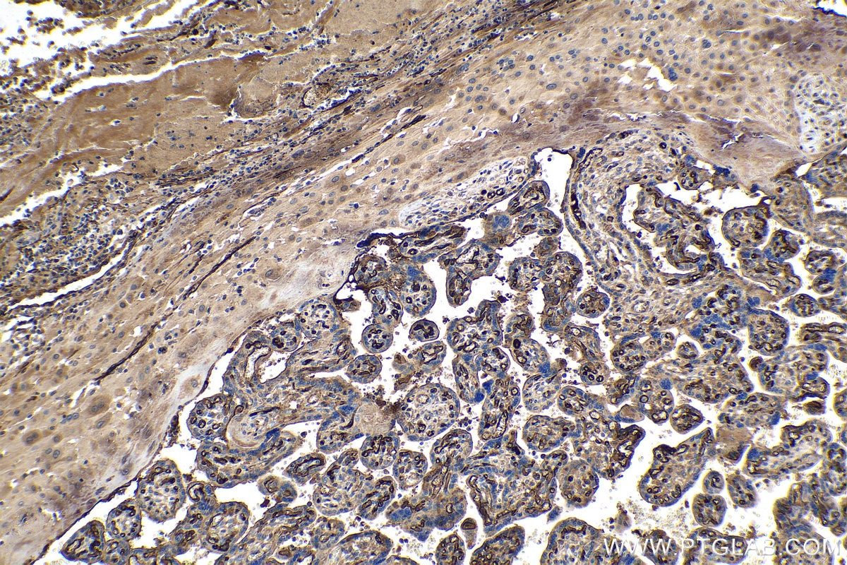 Immunohistochemistry (IHC) staining of human placenta tissue using Adiponectin Polyclonal antibody (21613-1-AP)