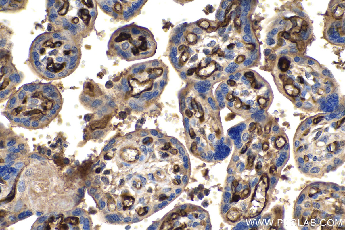 Immunohistochemistry (IHC) staining of human placenta tissue using Adiponectin Polyclonal antibody (21613-1-AP)