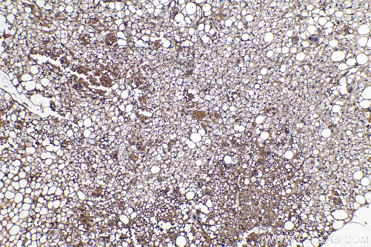 Immunohistochemistry (IHC) staining of rat brown adipose tissue using Adiponectin Polyclonal antibody (21613-1-AP)