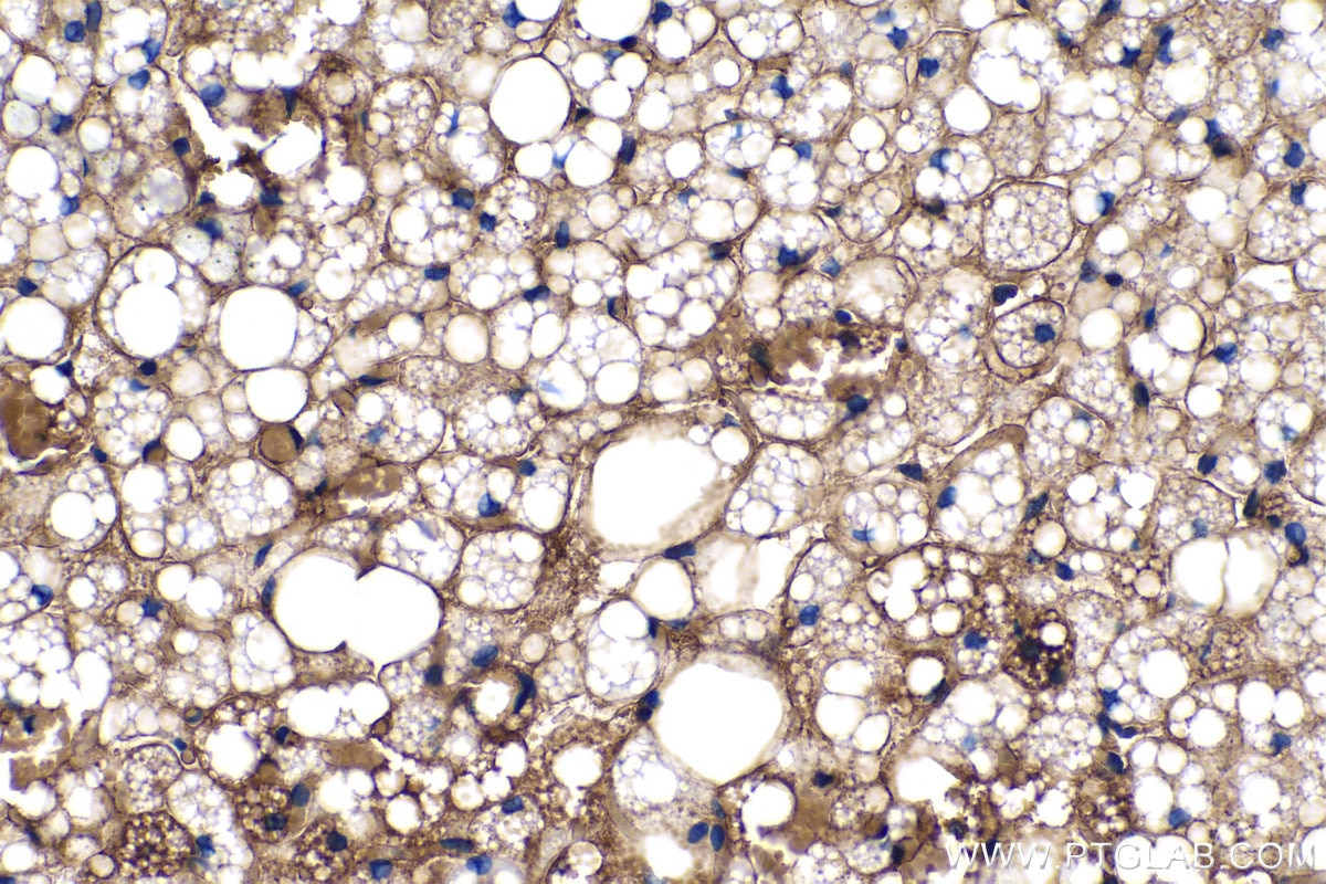 Immunohistochemistry (IHC) staining of rat brown adipose tissue using Adiponectin Polyclonal antibody (21613-1-AP)