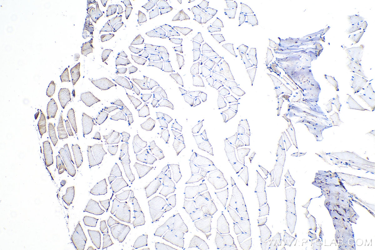 Immunohistochemistry (IHC) staining of mouse skeletal muscle tissue using Adiponectin Polyclonal antibody (21613-1-AP)