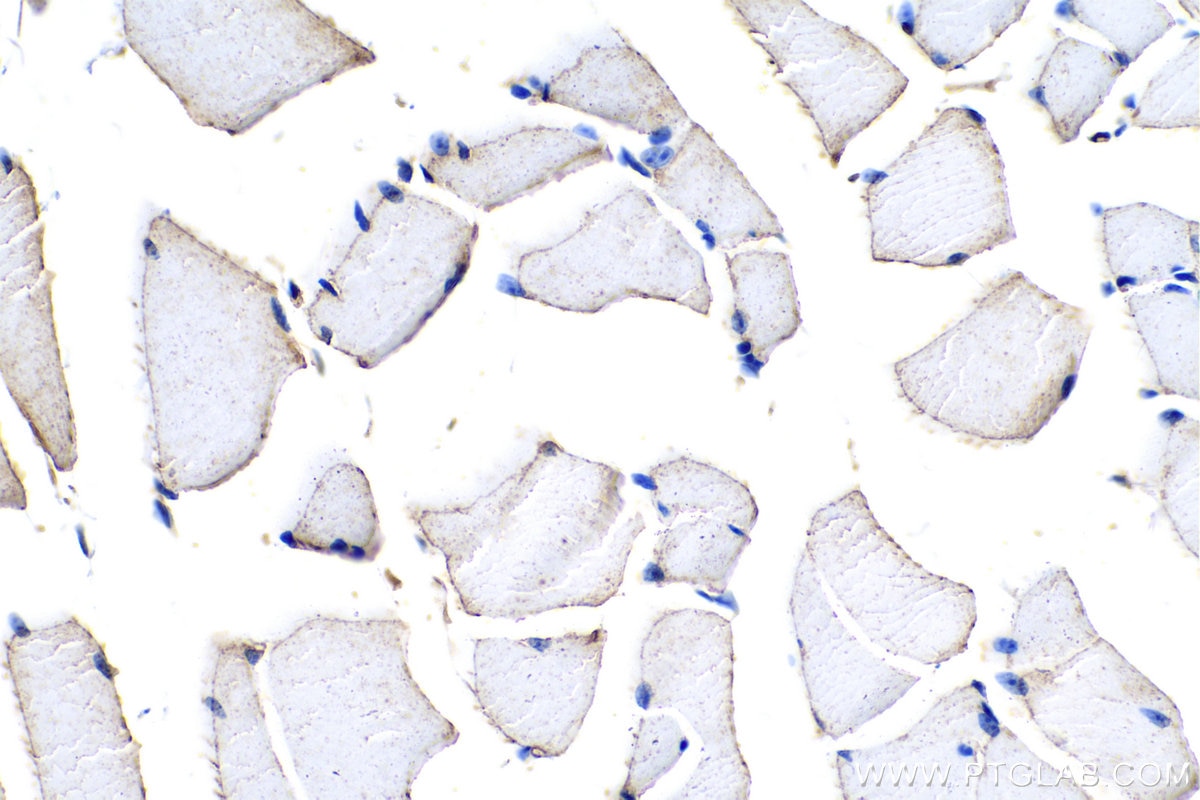 IHC staining of mouse skeletal muscle using 21613-1-AP