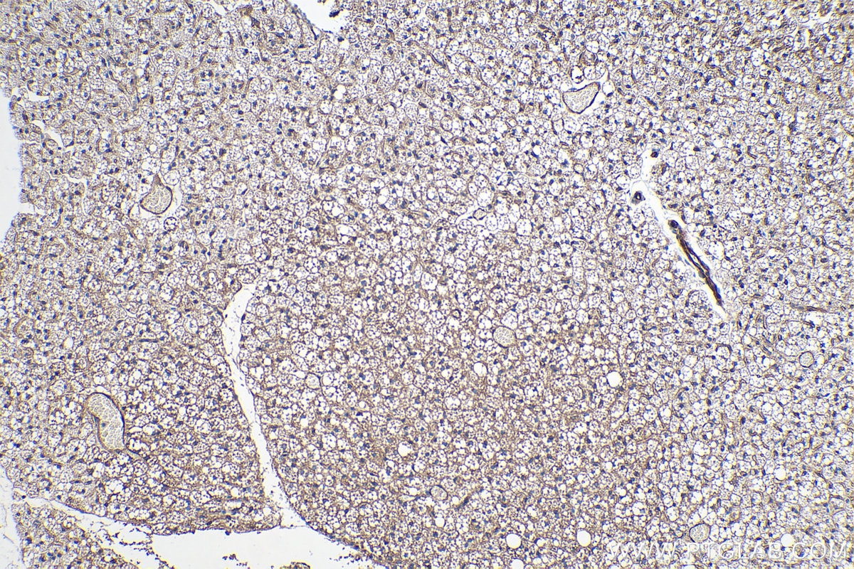 Immunohistochemistry (IHC) staining of mouse brown adipose tissue using Adiponectin Polyclonal antibody (21613-1-AP)