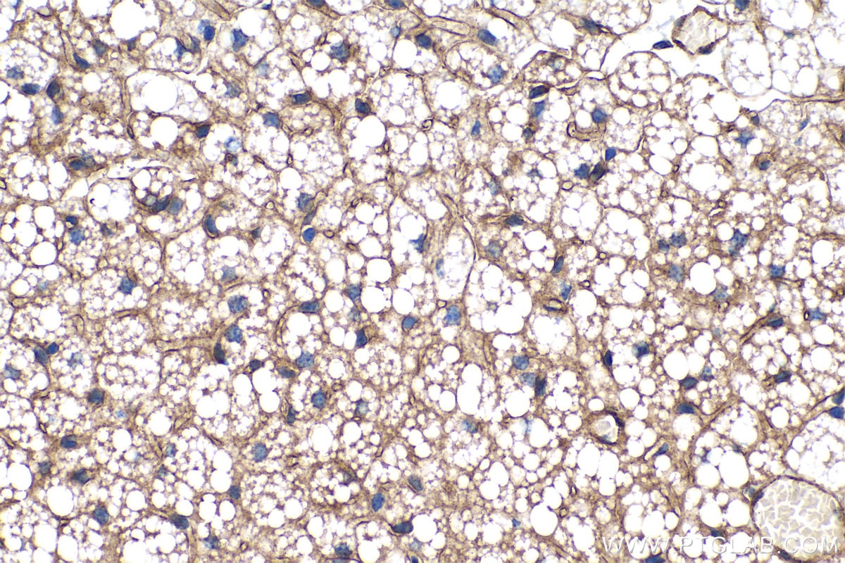 Immunohistochemistry (IHC) staining of mouse brown adipose tissue using Adiponectin Polyclonal antibody (21613-1-AP)