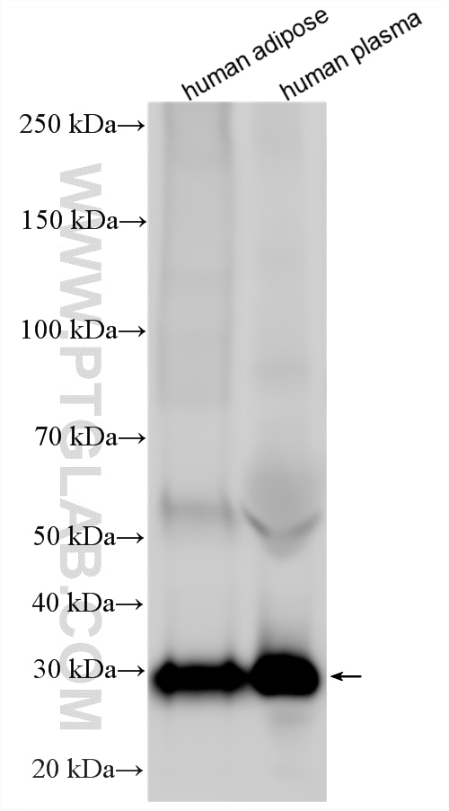WB analysis using 21613-1-AP Western Blot (WB) analysis of various lysates using Adiponectin Polyclonal antibody (21613-1-AP)