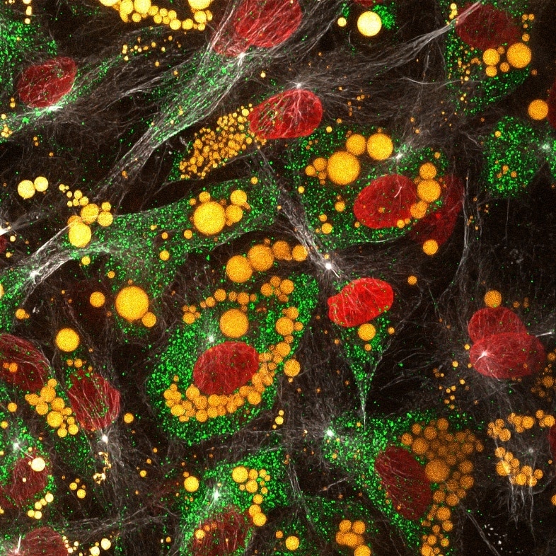 Immunofluorescence (IF) / fluorescent staining of human adipose-derived mesenchymal stem cells using Adiponectin Monoclonal antibody (66239-1-Ig)