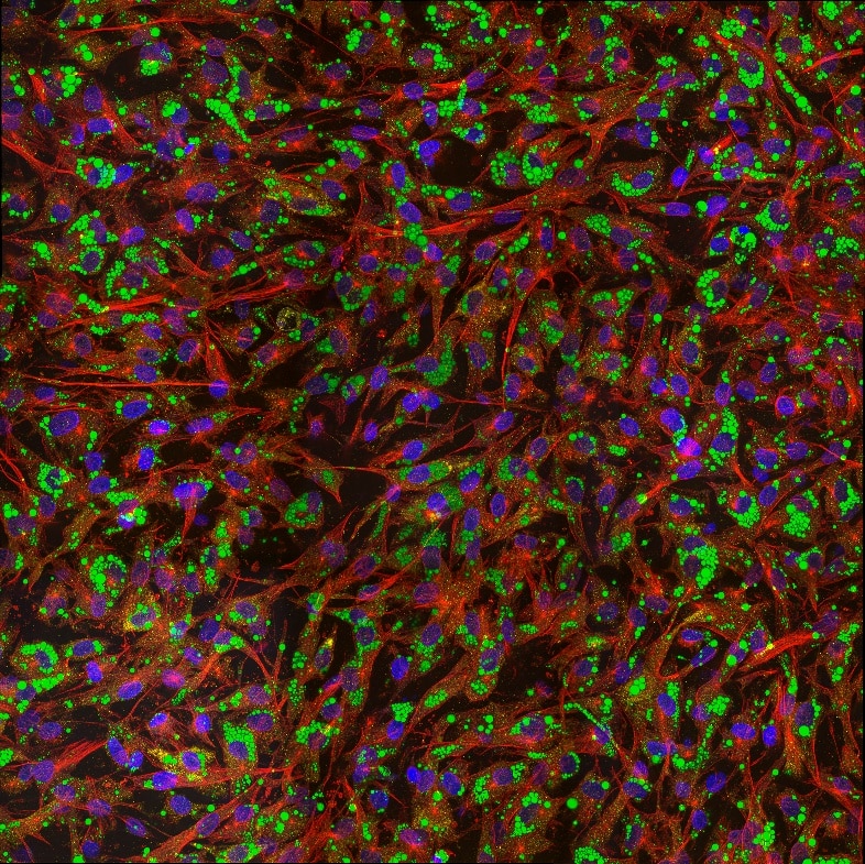 Immunofluorescence (IF) / fluorescent staining of human adipose-derived mesenchymal stem cells using Adiponectin Monoclonal antibody (66239-1-Ig)