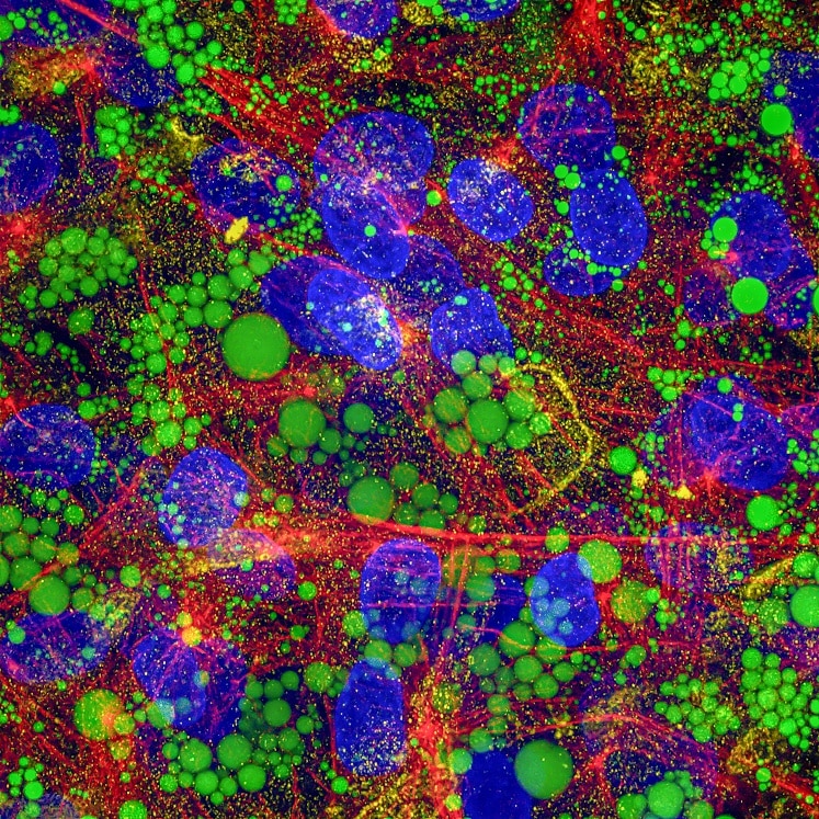 Immunofluorescence (IF) / fluorescent staining of human adipose-derived mesenchymal stem cells using Adiponectin Monoclonal antibody (66239-1-Ig)