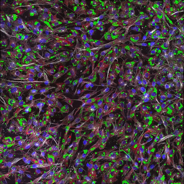 Immunofluorescence (IF) / fluorescent staining of human adipose-derived mesenchymal stem cells using Adiponectin Monoclonal antibody (66239-1-Ig)