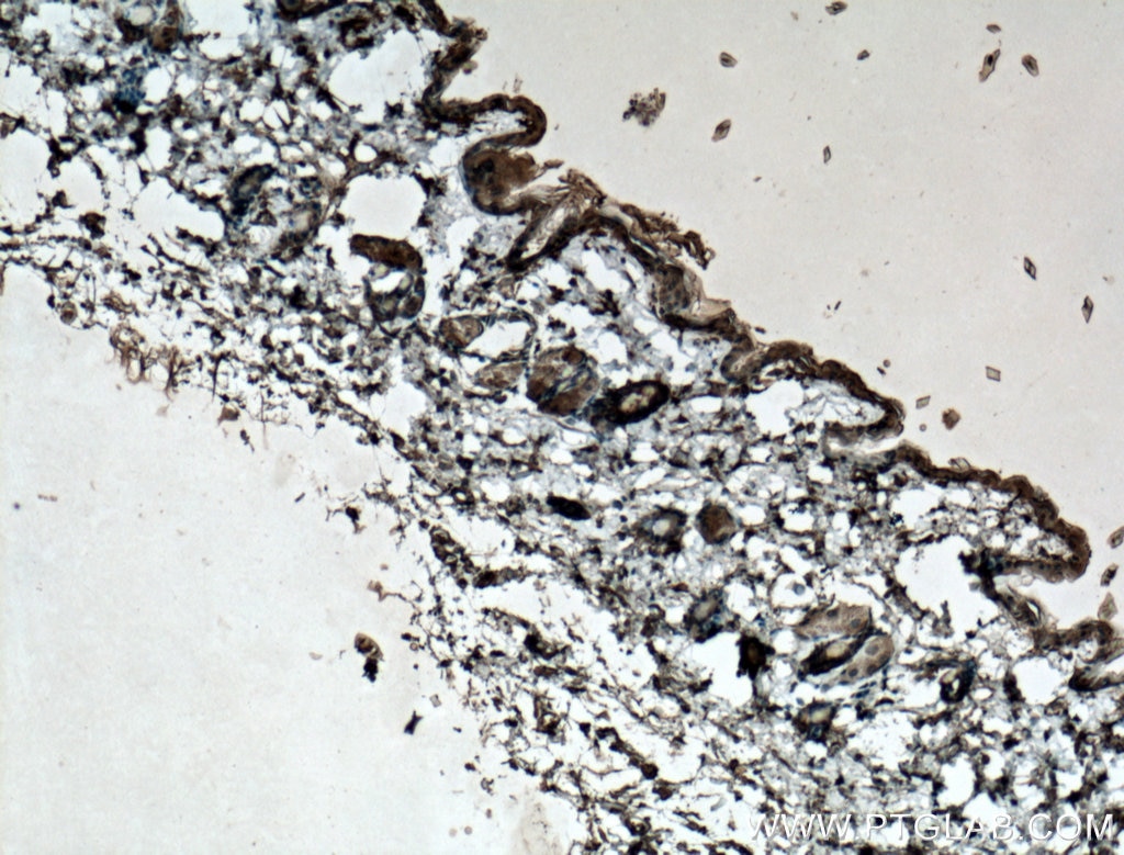 Immunohistochemistry (IHC) staining of mouse skin tissue using Adiponectin Monoclonal antibody (66239-1-Ig)