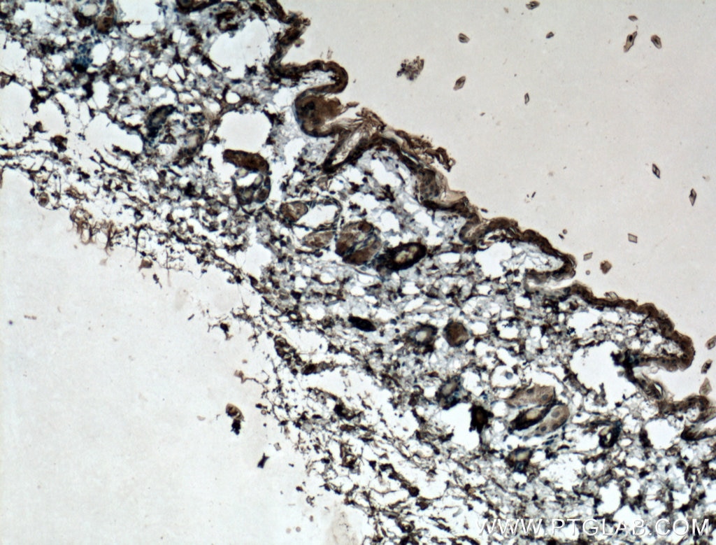 IHC staining of mouse skin using 66239-1-Ig