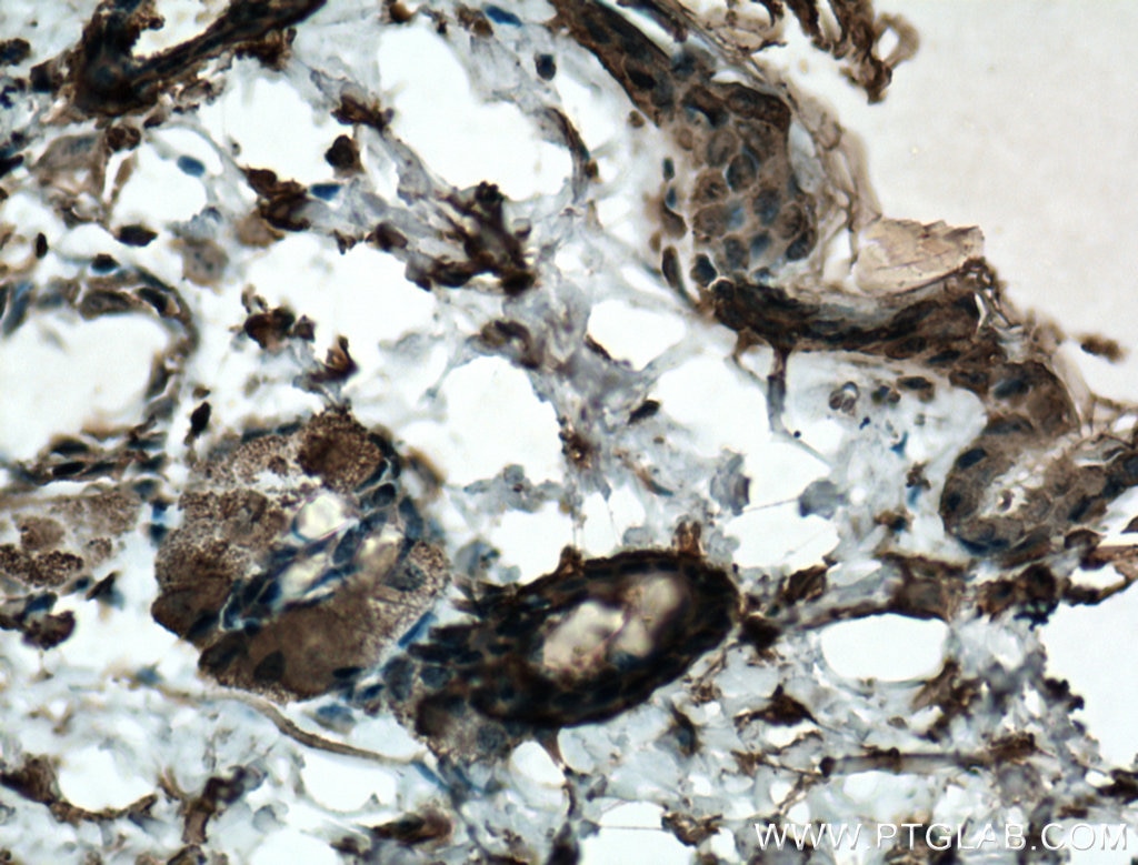 Immunohistochemistry (IHC) staining of mouse skin tissue using Adiponectin Monoclonal antibody (66239-1-Ig)