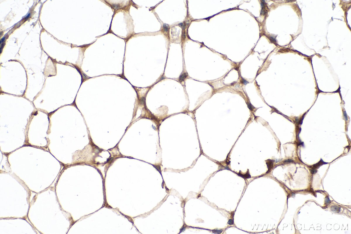 IHC staining of mouse brown adipose using 66239-1-Ig