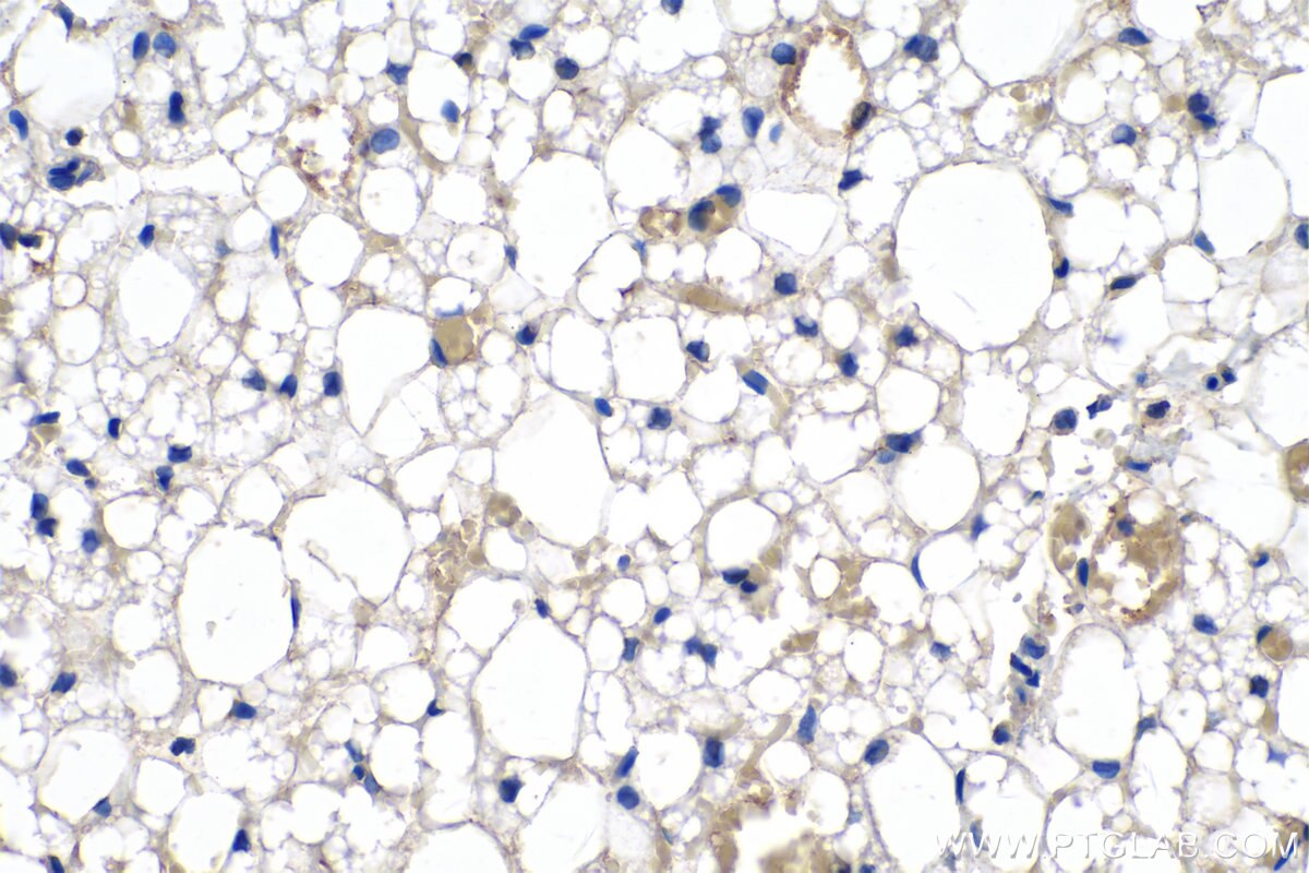 IHC staining of rat brown adipose using 66239-1-Ig