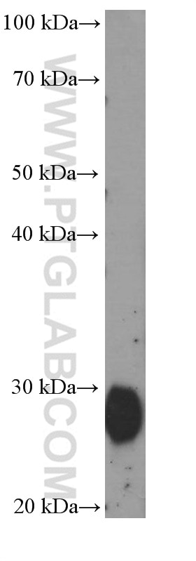 Western Blot (WB) analysis of human adipose tissue using Adiponectin Monoclonal antibody (66239-1-Ig)