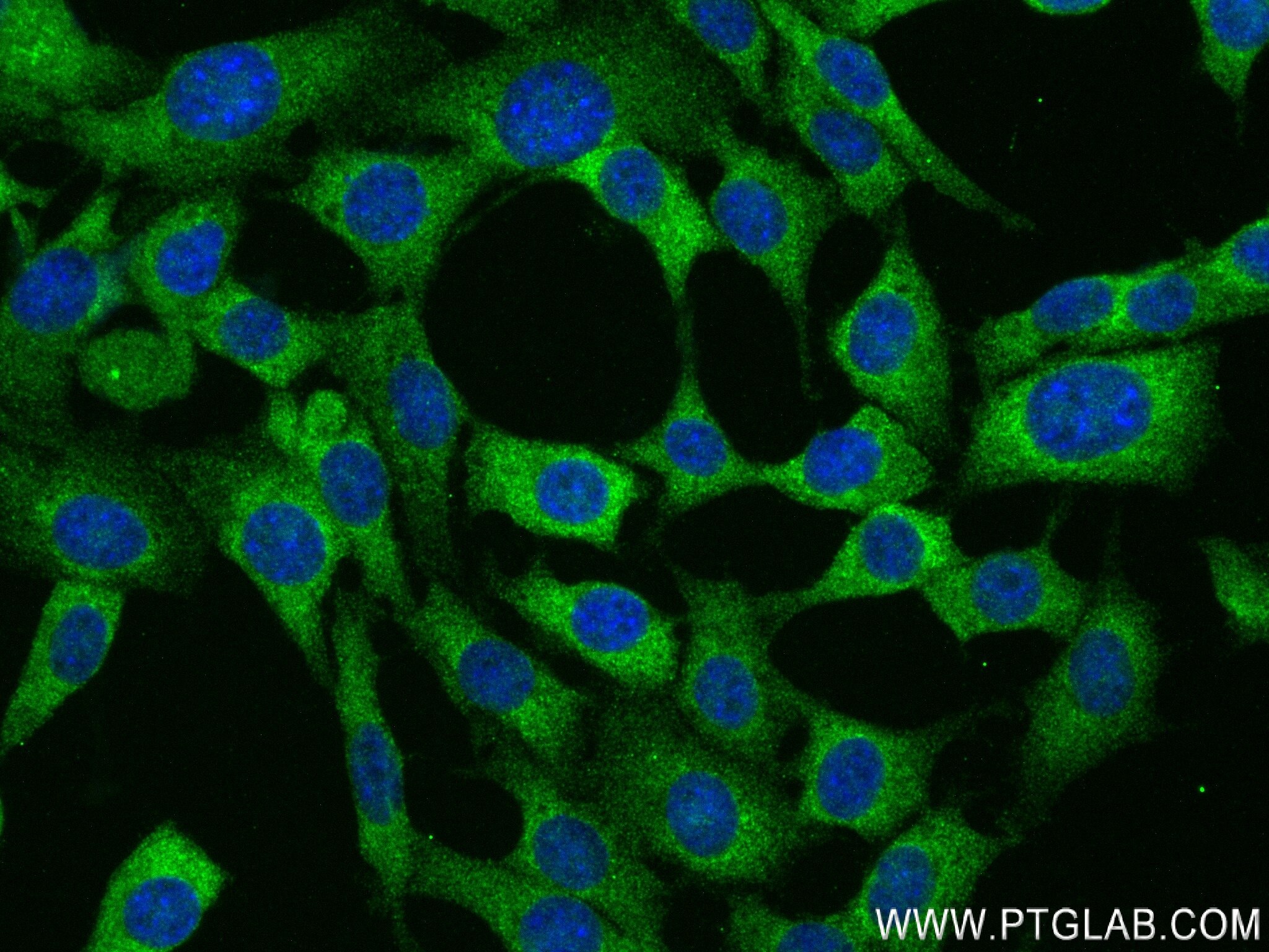 Immunofluorescence (IF) / fluorescent staining of 3T3-L1 cells using ADIPOQ Recombinant antibody (83961-3-RR)