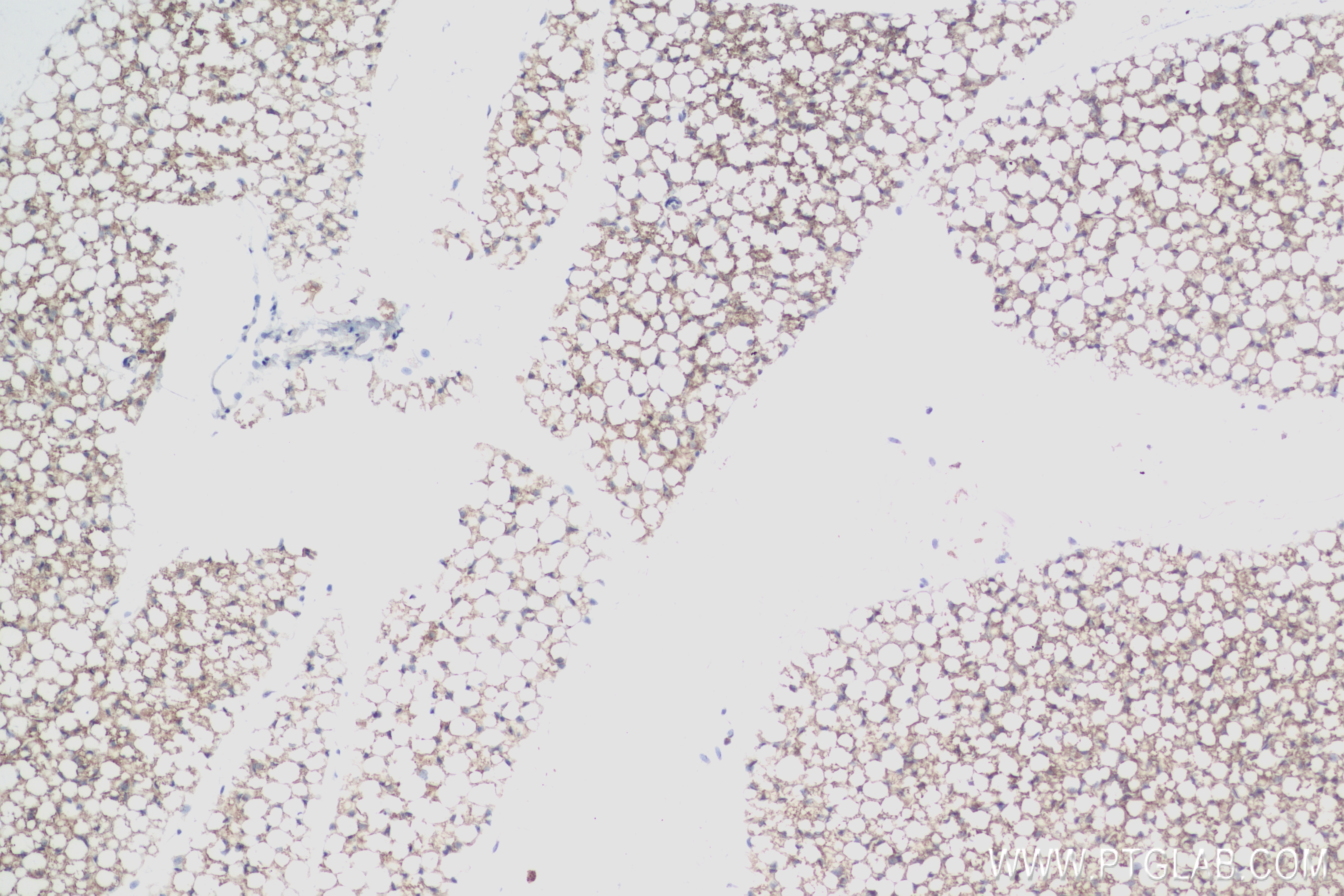 Immunohistochemistry (IHC) staining of mouse brown adipose tissue using ADIPOQ Recombinant antibody (83961-3-RR)