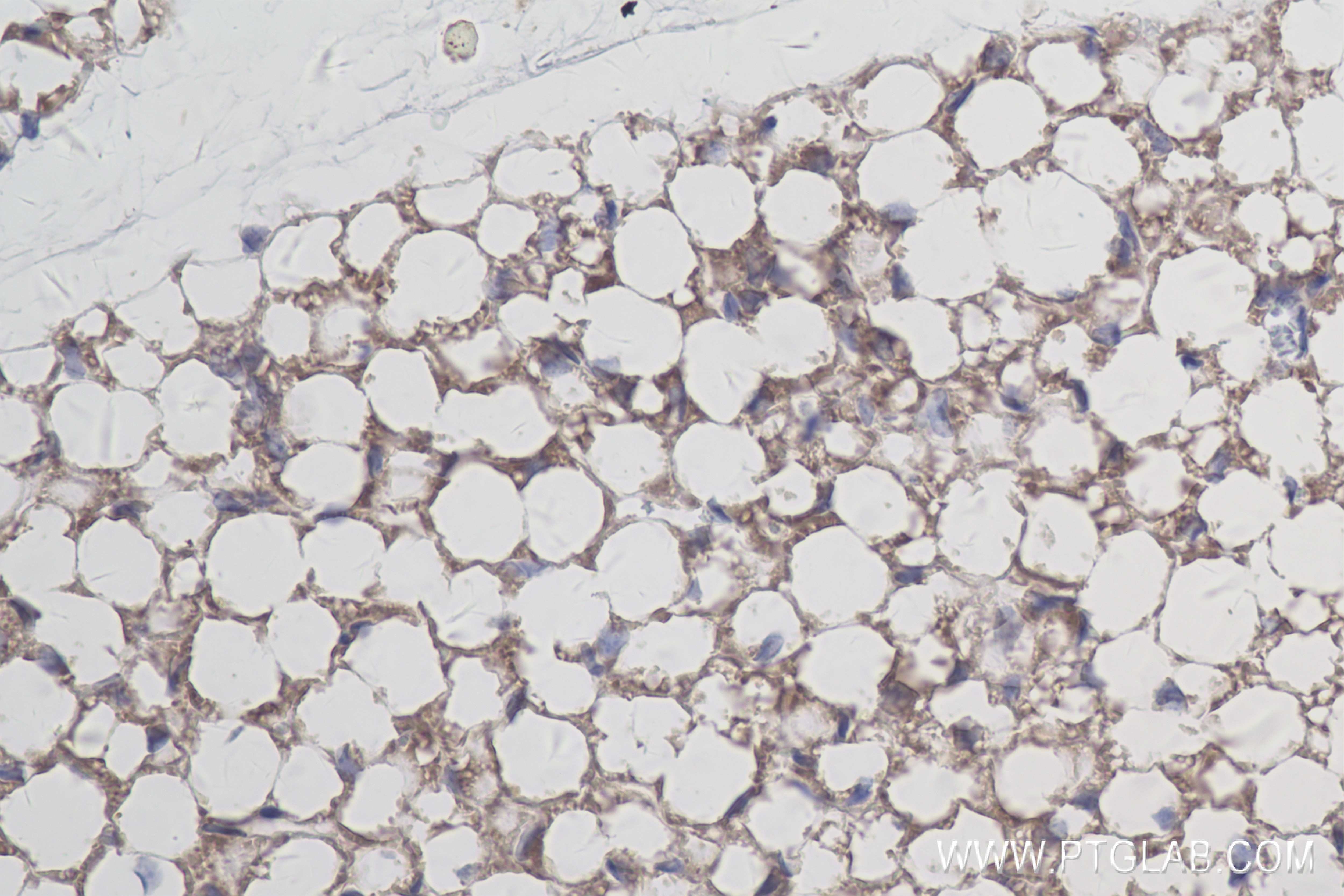 Immunohistochemistry (IHC) staining of mouse brown adipose tissue using ADIPOQ Recombinant antibody (83961-3-RR)