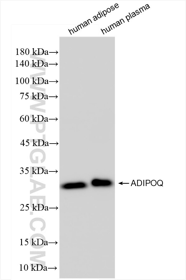 Western Blot (WB) analysis of various lysates using Adiponectin Recombinant antibody (83961-4-RR)