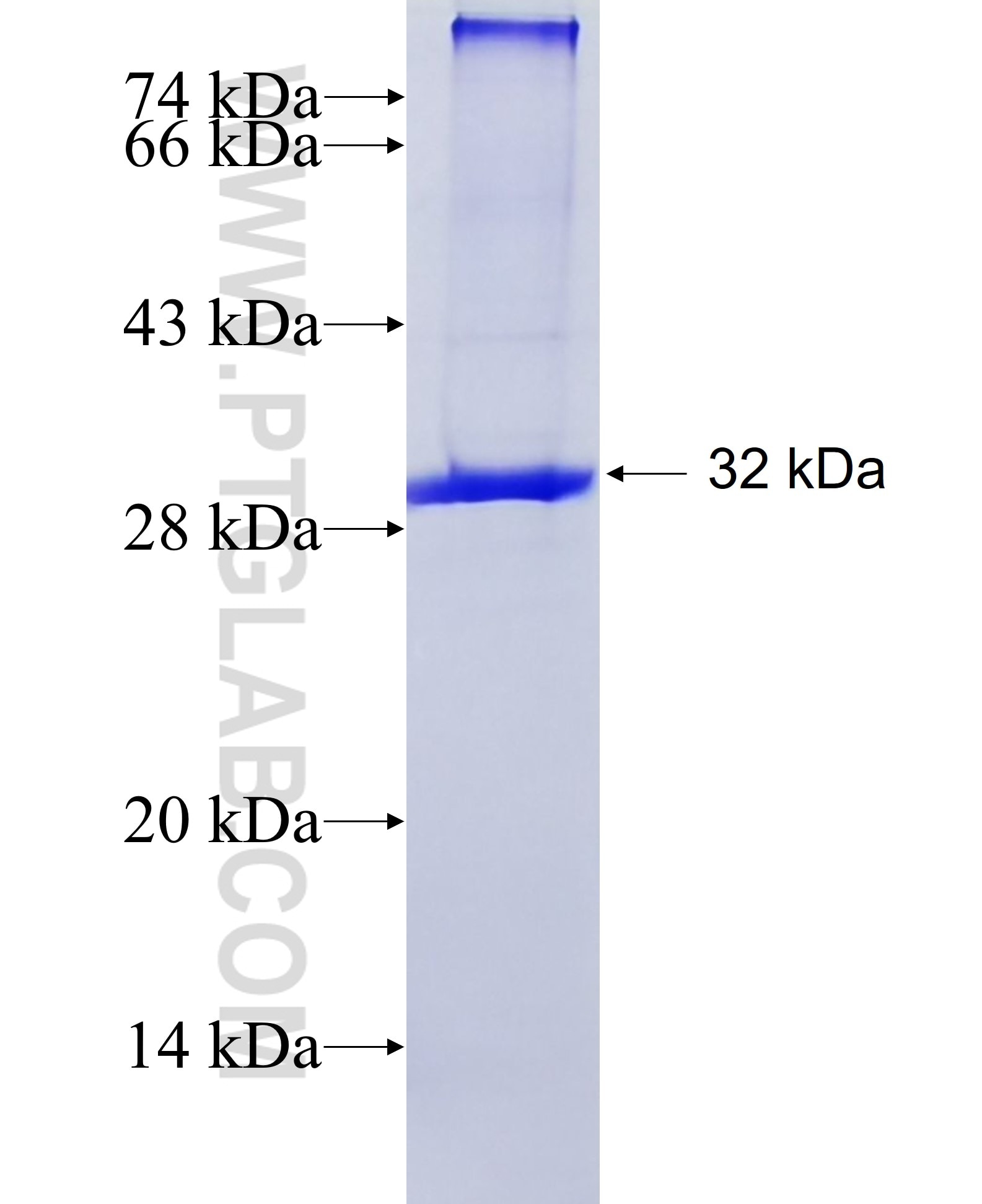 ADIPOQ fusion protein Ag17383 SDS-PAGE