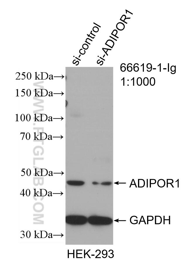 Western Blot (WB) analysis of HEK-293 cells using Adiponectin receptor 1 Monoclonal antibody (66619-1-Ig)