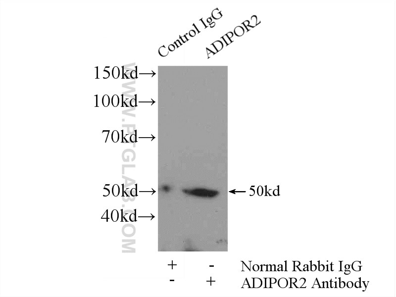 Adiponectin receptor