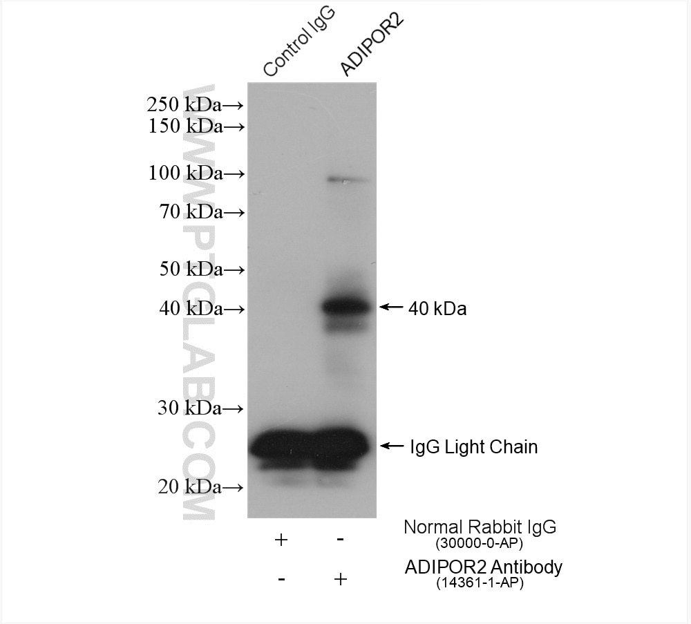 Immunoprecipitation (IP) experiment of mouse liver tissue using Adiponectin receptor Polyclonal antibody (14361-1-AP)