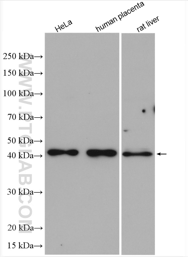 Western Blot (WB) analysis of various lysates using Adiponectin receptor Polyclonal antibody (14361-1-AP)