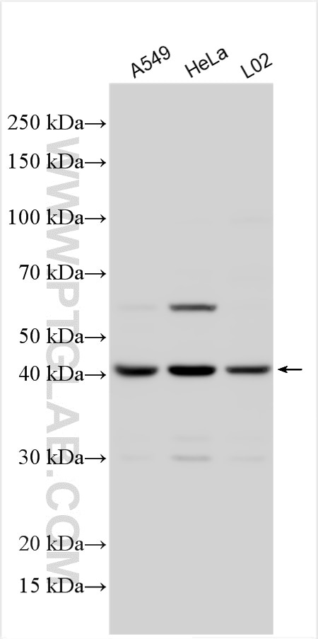 Western Blot (WB) analysis of various lysates using Adiponectin receptor Polyclonal antibody (14361-1-AP)