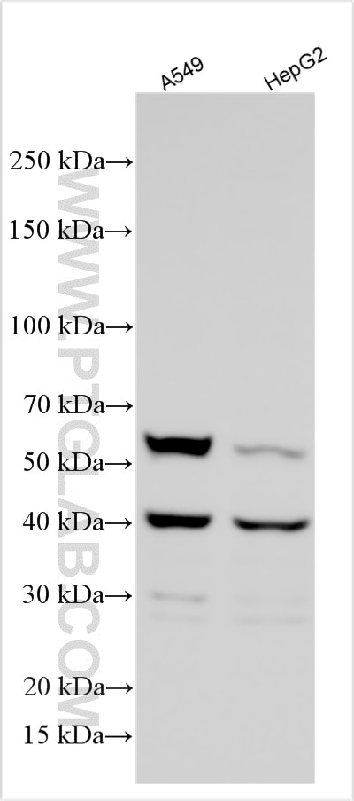 WB analysis using 14361-1-AP Western Blot (WB) analysis of various lysates using Adiponectin receptor Polyclonal antibody (14361-1-AP)
