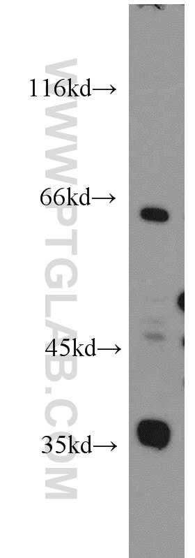 Adiponectin receptor