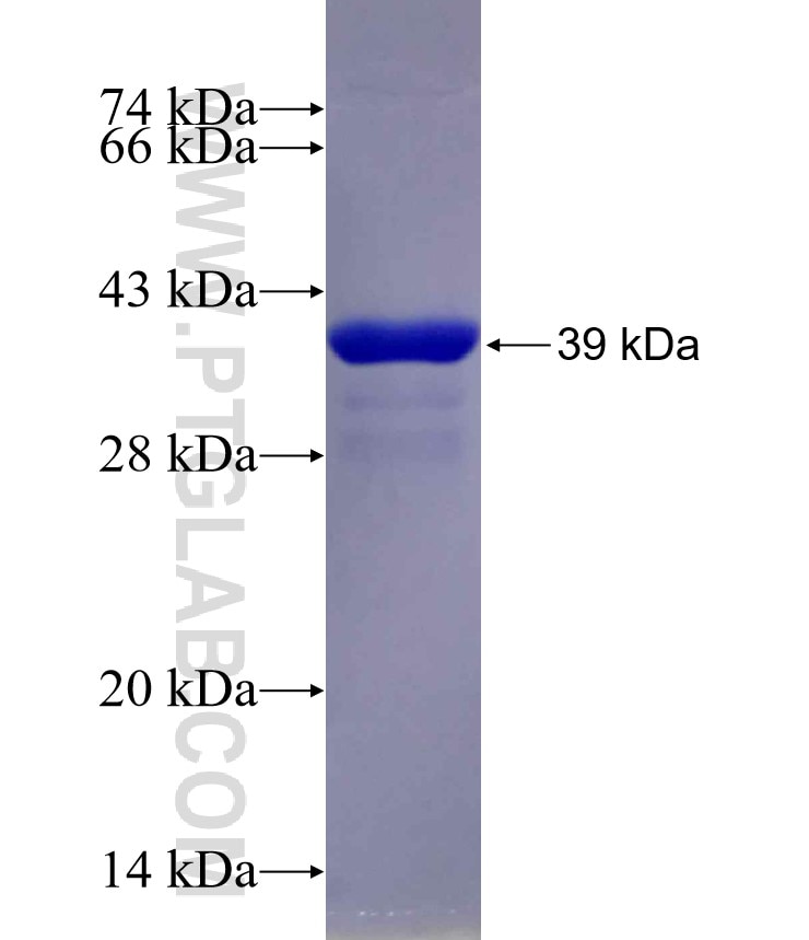 ADIPOR2 fusion protein Ag29864 SDS-PAGE