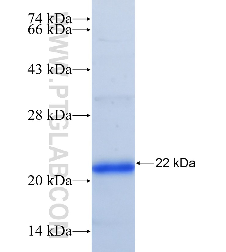 ADIPOR2 fusion protein Ag29883 SDS-PAGE