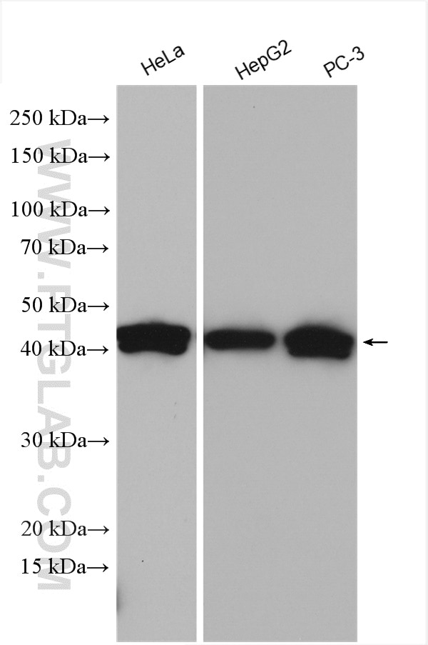 Western Blot (WB) analysis of various lysates using ADK Polyclonal antibody (15477-1-AP)