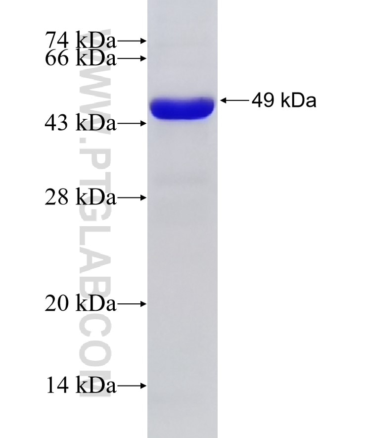 ADK fusion protein Ag7466 SDS-PAGE