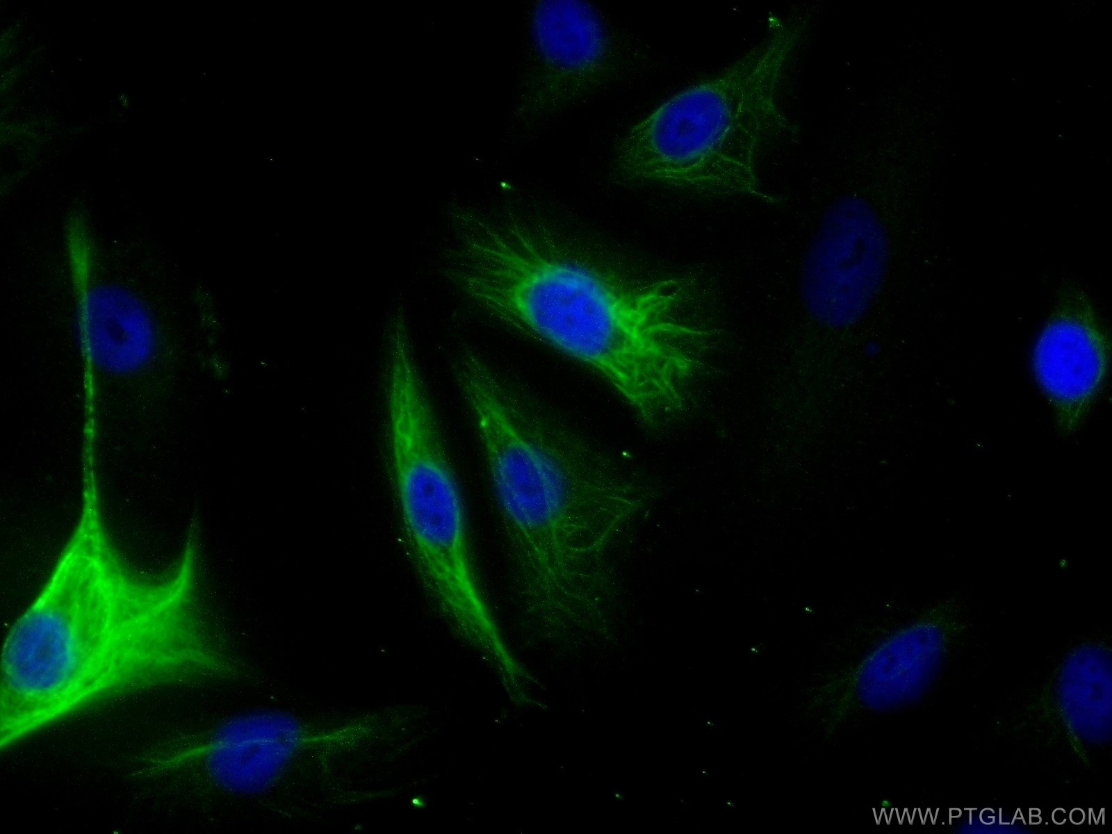 Immunofluorescence (IF) / fluorescent staining of A549 cells using Adrenomedullin Polyclonal antibody (10778-1-AP)