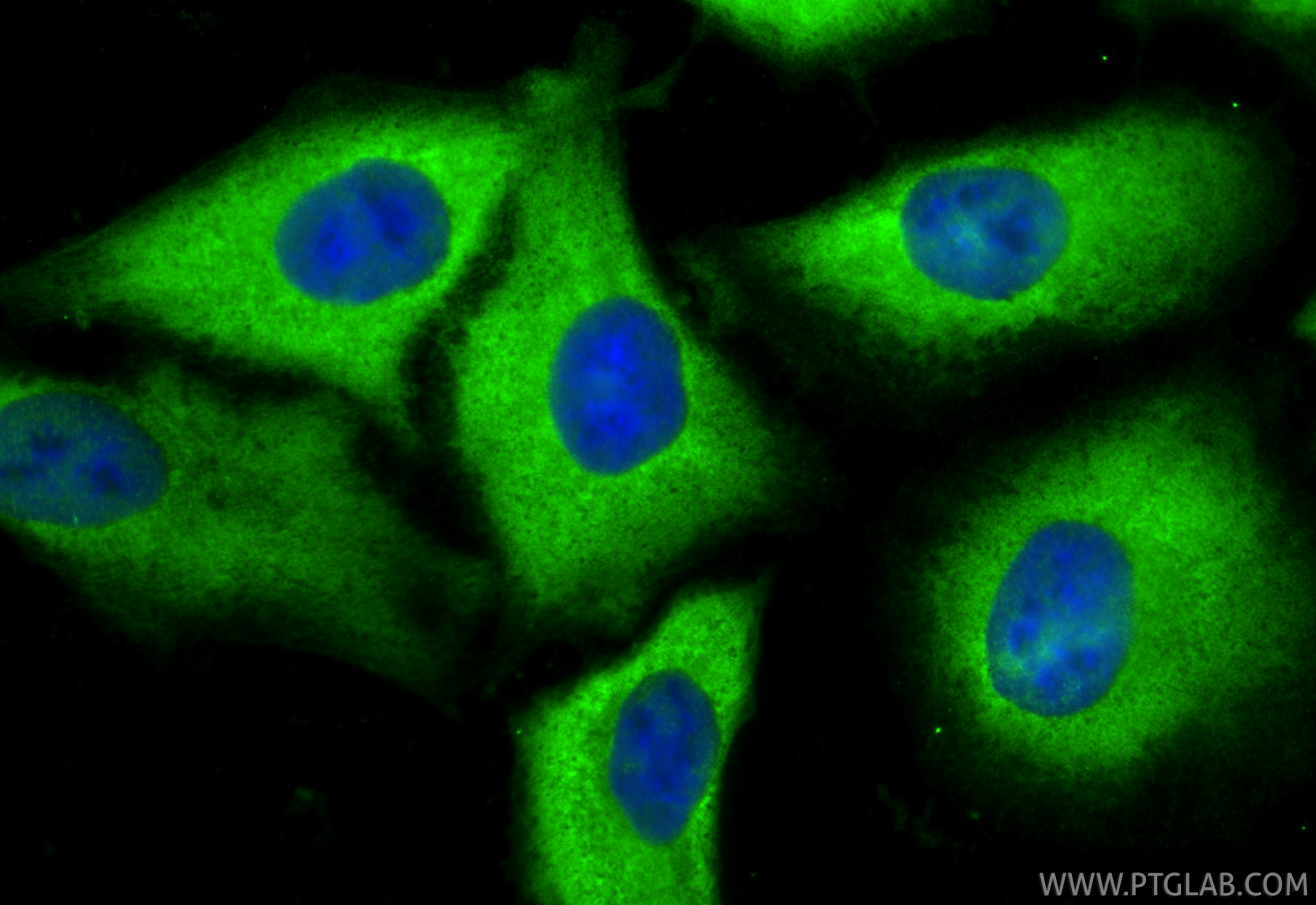 Immunofluorescence (IF) / fluorescent staining of A549 cells using Adrenomedullin Polyclonal antibody (10778-1-AP)