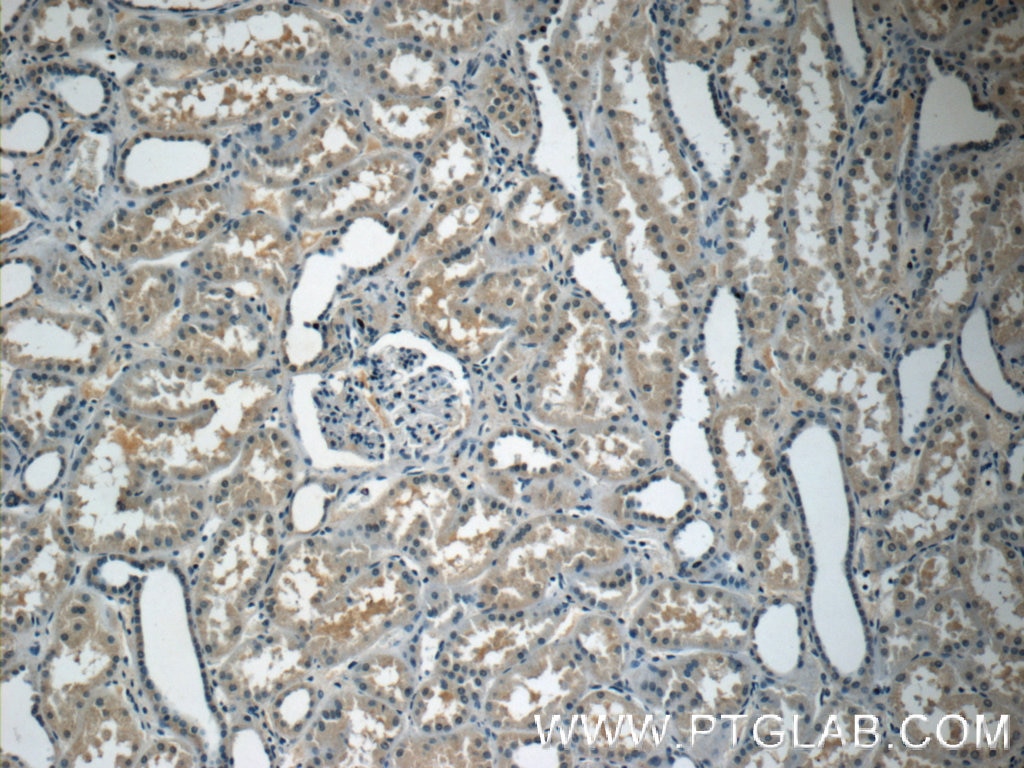 Immunohistochemistry (IHC) staining of human kidney tissue using Adrenomedullin Polyclonal antibody (10778-1-AP)