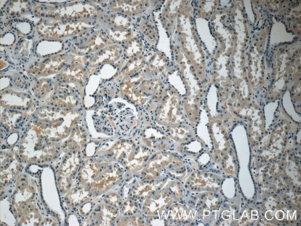 IHC staining of human kidney using 10778-1-AP