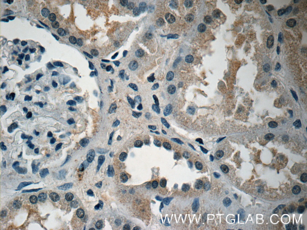 Immunohistochemistry (IHC) staining of human kidney tissue using Adrenomedullin Polyclonal antibody (10778-1-AP)