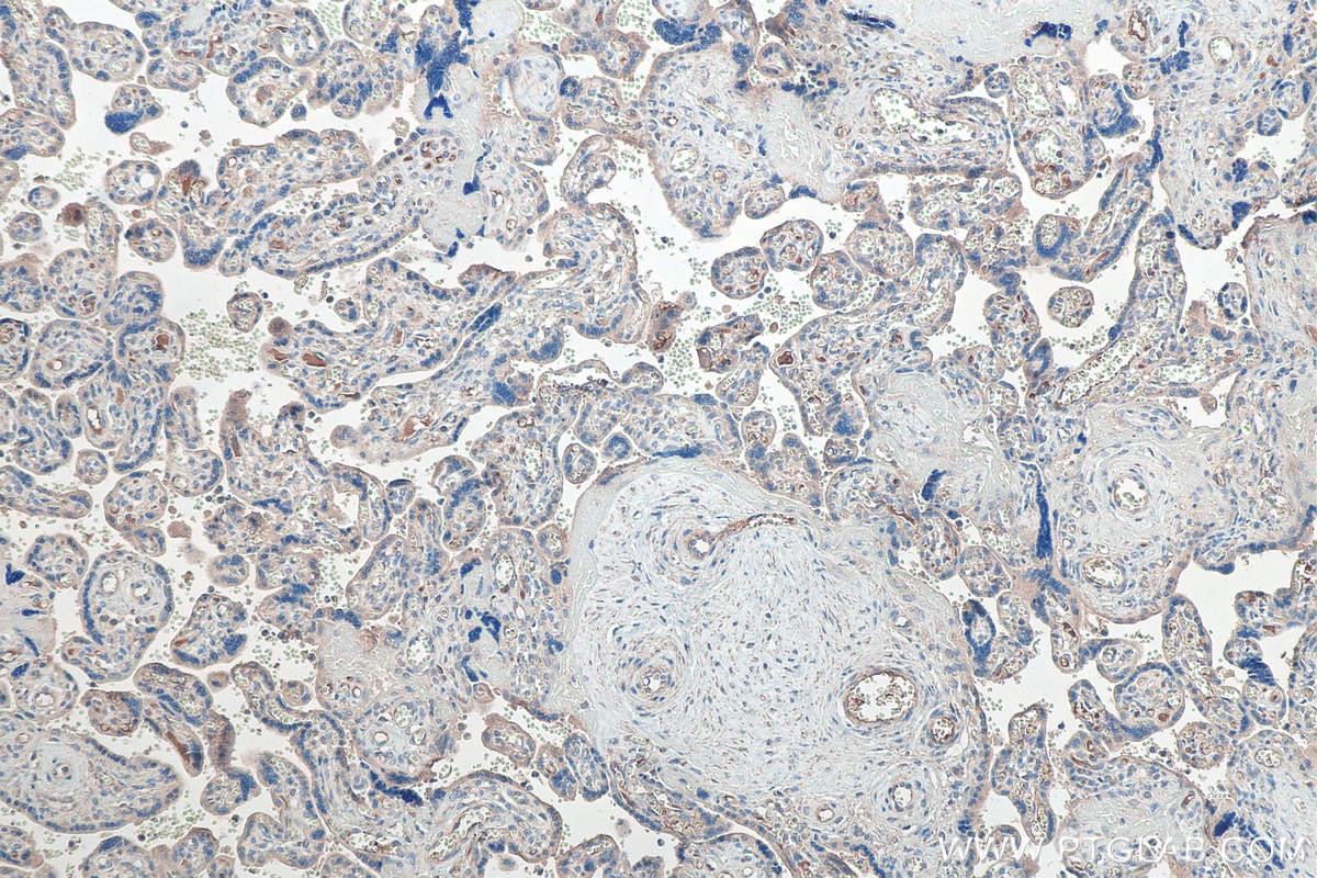 Immunohistochemistry (IHC) staining of human placenta tissue using Adrenomedullin Polyclonal antibody (10778-1-AP)