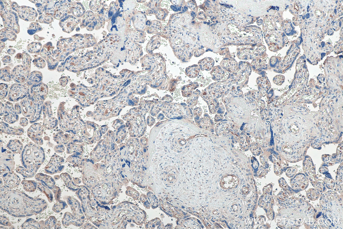 IHC staining of human placenta using 10778-1-AP