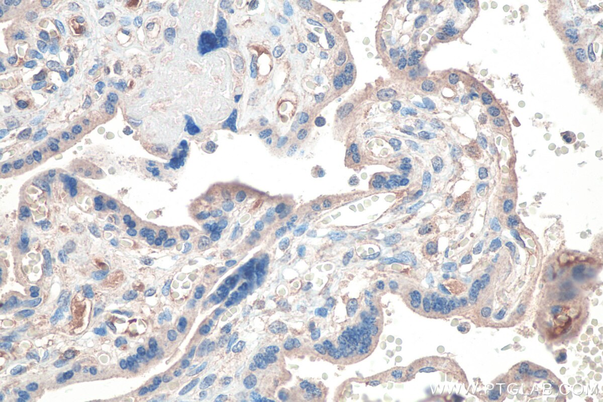 Immunohistochemistry (IHC) staining of human placenta tissue using Adrenomedullin Polyclonal antibody (10778-1-AP)