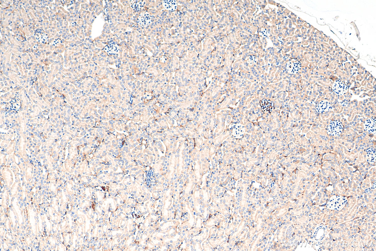 Immunohistochemistry (IHC) staining of mouse kidney tissue using Adrenomedullin Polyclonal antibody (10778-1-AP)